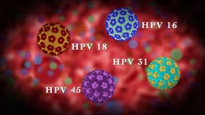 The HPV Vaccine Push