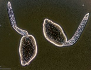 cercaria_of_trematode_259_22