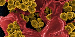 Deaths From Antibiotic-Resistant “Superbugs” Will Outpace Cancer Deaths By 2050