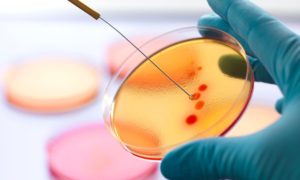 Pills For Everyone: Up To One-Third Of Antibiotics Prescribed Incorrectly