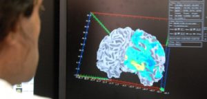 Altered Brain Activity In Obese Women: Study Shows That Activity In The Reward Centers Of Obese Women React Differently To Food