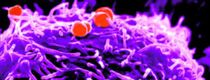 If You’re Unhappy And You Know It: European CDC Reports Gonorrhea Cases Have Doubled