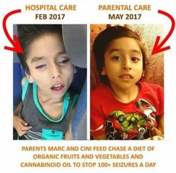 Vaccine Damaged Child Medically Kidnapped when Parents Refuse Toxic Chemicals and Choose Organic Foods