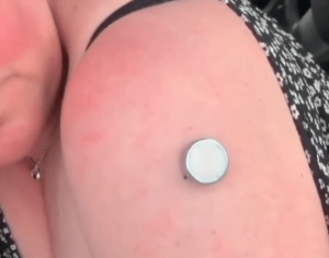 Why are Magnets Sticking to the COVID Vaxxed?
