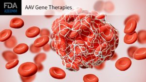 Regular Blood Work After Gene Therapy Warranted by Rare Condition