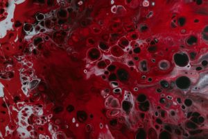 Characteristics and Outcomes of Patients With Cerebral Venous Sinus Thrombosis in SARS-CoV-2 Vaccine–Induced Immune Thrombotic Thrombocytopenia