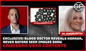 Never Before Seen: Blood Doctor Reveals HORRIFIC Findings After Examining Vials