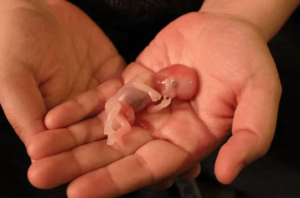 COVID vaccines and pregnancy: >416,186 spontaneous abortions due to the vaccine